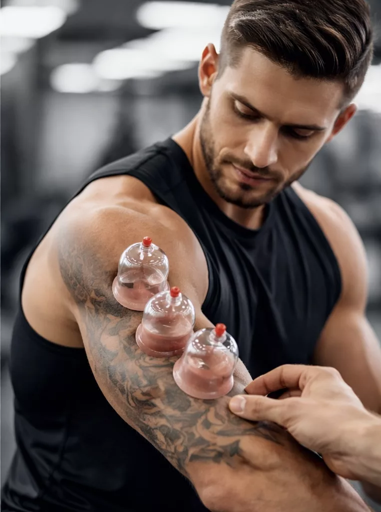Cupping Therapy helps release fascia and connective tissue restrictions. It improve muscle recovery after exercise.