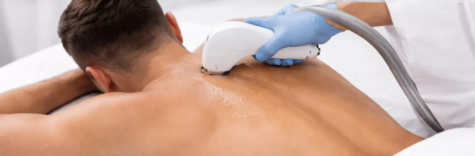 Laser hair removal Newmarket men back treatment clinic