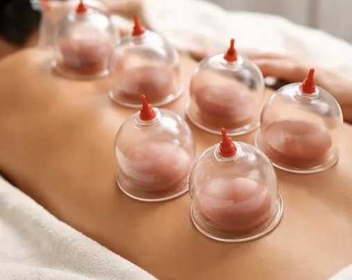 Cupping Therapy reduce muscle fatigue, improve flexibility and range of motion