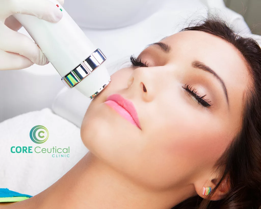 HIFU jawline contouring in Newmarket